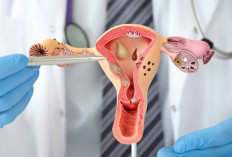 Jangan Sampai Terlambat, Ini 4 Langkah Mudah Cegah Kanker Serviks