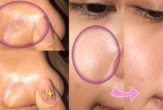 7 Tips Cara Membersihkan Komedo agar Wajah Jadi Bersih dan Glowing Bebas Flek Hitam, Salah Satunya Pakai Lemon