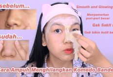 Lakukan 5 Cara Ini Agar Wajah Bersih dari Komedo Gais, Nomor 2 Cuma Modal Air Aja Lho!