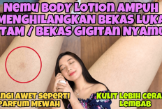 5 Handbody Terbaik untuk Menghilangkan Bekas Luka dan Mencerahkan Kulit, Nomor 1 Ada di Indomaret, Yuk Cobain!