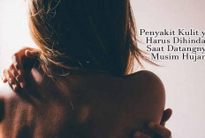 Waspada! 5 Penyakit Kulit yang Harus Dihindari Saat Datangnya Musim Hujan