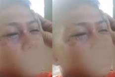 Video Bocah Diduga Dipukuli Oknum Polisi Pekanbaru hingga Mata Lebam, Propam Polda Riau Bergerak