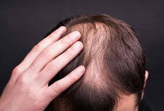 Waspada! Kerontokan Rambut: Tanda Awal Tersembunyi dari Diabetes Tipe 2