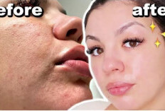 Tak Perlu Beli Skincare Mahal, 5 Bahan Alami Ini Bisa Mengecilkan Pori-Pori dan Bikin Wajah Mulus dan Glowing!