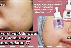 3 Rekomendasi Serum Scarlett untuk Bruntusan Bisa Bikin Kulit Halus & Glowing dalam 7 Hari, Cobain Sekarang!