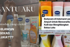 5 Body Lotion Terbaik untuk Hilangkan Bekas Luka, Cukup Pakai 7 Hari Kulit Jadi Mulus dan Putih, Yuk Cobain!