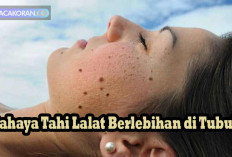 Jangan Dianggap Sepele, Ini Bahaya Tahi Lalat berlebihan di Tubuh.