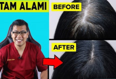 Wajib Coba! 4 Cara Ampuh Menghilangkan Uban Dengan Minyak Kayu Putih, Yuk Ikutin Gais