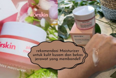 Bingung Kulit Wajah Kusam Terus? Cobain 5 Moisturizer Mencerahkan Ini Gais, Bekas Jerawat Ikut Keangkut..