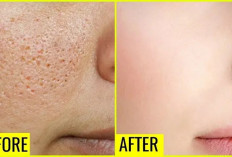  5 Cara Alami Mengecilkan Pori-Pori Wajah, Hasil Glowing Seperti Artis Korea!