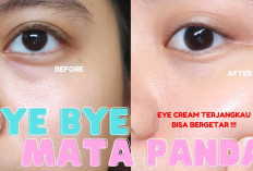 Sist, 5 Macam Eye Cream Terbaik Bersertifikat BPOM Under 100k, Apa Aja?