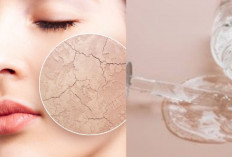 5 Rekomendasi Serum Ampuh untuk Kulit Kering, Bikin Wajah Lembap & Glowing!