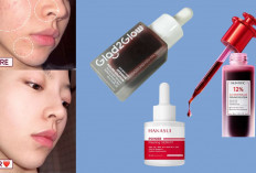 Kulit Kusam? Coba Rekomendasi Peeling Serum ini Bisa Ngangkat Sel Kulit Mati, Eksfoliasi Cepat Cuma 60 Detik!