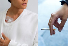 Tak Hanya Orang Tua, Peneliti Ungkap Stroke Dapat Menyerang Anak Muda, Rokok Jadi Penyebabnya?