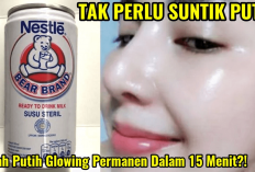 Nggak Perlu Suntik Putih Girls! Cukup Pakai 3 Racikan Masker Susu Bear Brand Ini Wajah Auto Glowing Lho