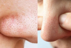 Skincare Rutin untuk Mengecilkan Pori-Pori Hidung dan Pipi dengan Cepat, Bikin Kulit Halus & Cerah dalam 7 Har
