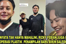 Mengejutkan! Rizky Febian dan Mahalini Raharja Unjuk Penampilan Baru Usai Diduga Oplas Hidung