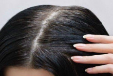 Cara Menghilangkan Uban di Usia Muda Secara Alami dalam 1 Minggu, Tanpa Cat Rambut Kimia
