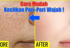 4 Obat Pengecil Pori-pori Wajah Terbaik 2024, Bikin Wajah Mulus dalam 1 Minggu, Cobain Bestie!