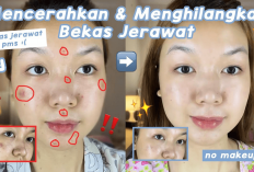 5 Rekomendasi Moisturizer yang Mencerahkan Bikin Noda Hitam dan Kulit Belang Auto Cerah, Cobain Aja Girls!