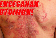 Yuk Pahami Penyebab, Bahaya dan Upaya Pencegahan dari Penyakit Autoimun, Simak Disini!