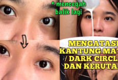 4 Efek Begadang yang Buruk Pada Wajah, Salah Satunya Bisa Bikin Keriput dan Mata Hitam, Kok Bisa?