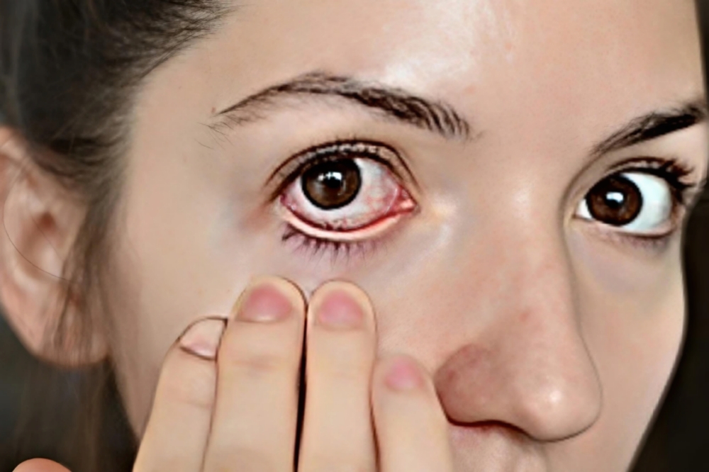 Gaes 8 Kebiasaan ini Harus di Hindari, Bisa Bikin Mata Kamu Rusak, Nomor 5 Sering Disepelehkan