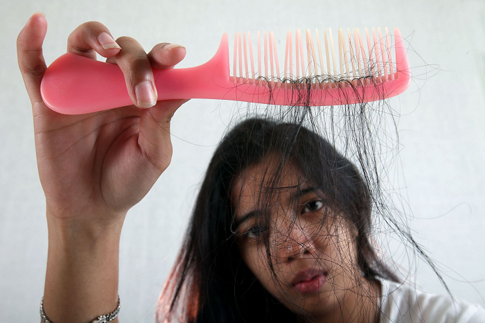 Jangan Terlalu Stress Bisa Bikin Rambut Rontok, Ternyata Ini Penyebabnya!